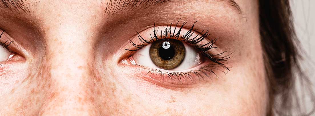 Desprendimiento de retina, accidente laboral