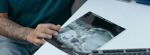 Indemnización por latigazo cervical