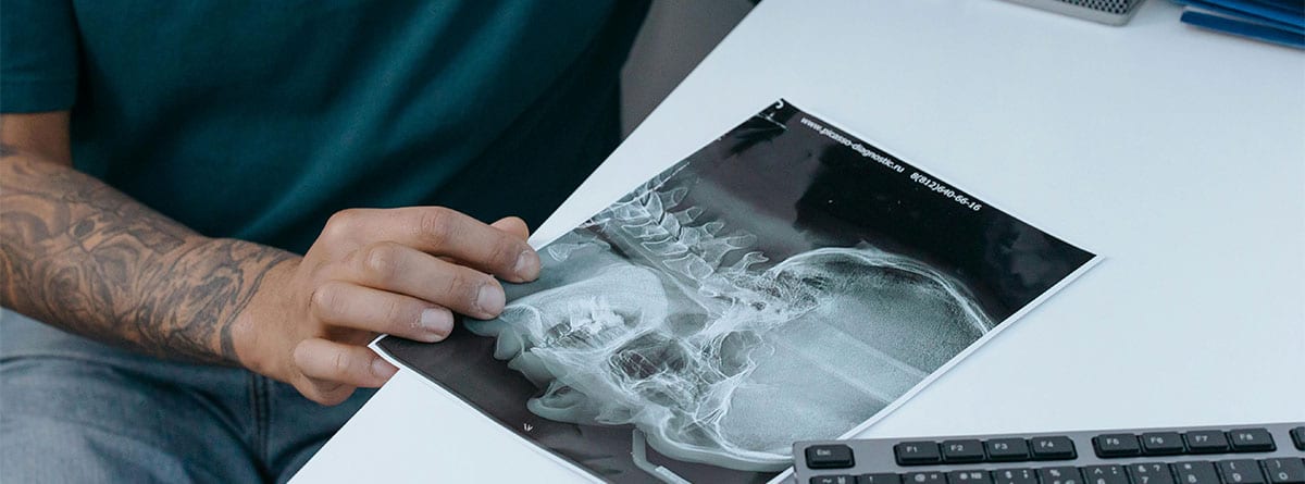 Indemnización por latigazo cervical